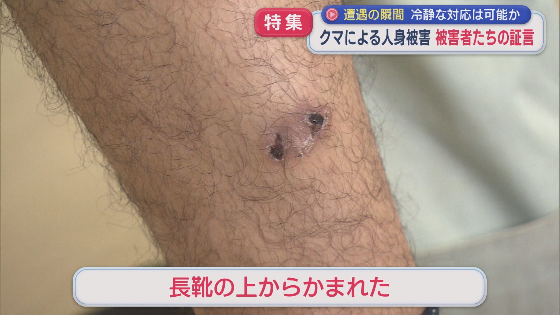 【特集】クマに襲われた被害者たちの証言「首をかまれていたかも」県内の人身被害は過去最多のペース【新潟】